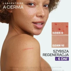 Aderma Epitheliale Ultra Repair, krem regenerujący przeciw śladom, 100 ml