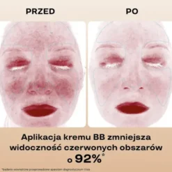 BasicLab Beauties, nawilżający krem,BB SPF15, Beige, 33 ml