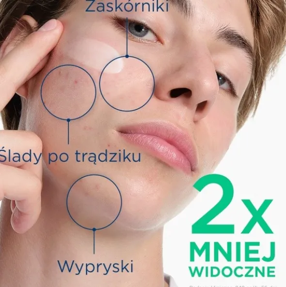 Bioderma Sebium Kerato+, żel-krem przeciwtrądzikowy, 30 ml