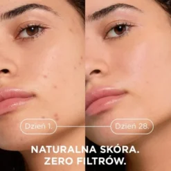 Bioderma Sebium Kerato+, żel-krem przeciwtrądzikowy, 30 ml