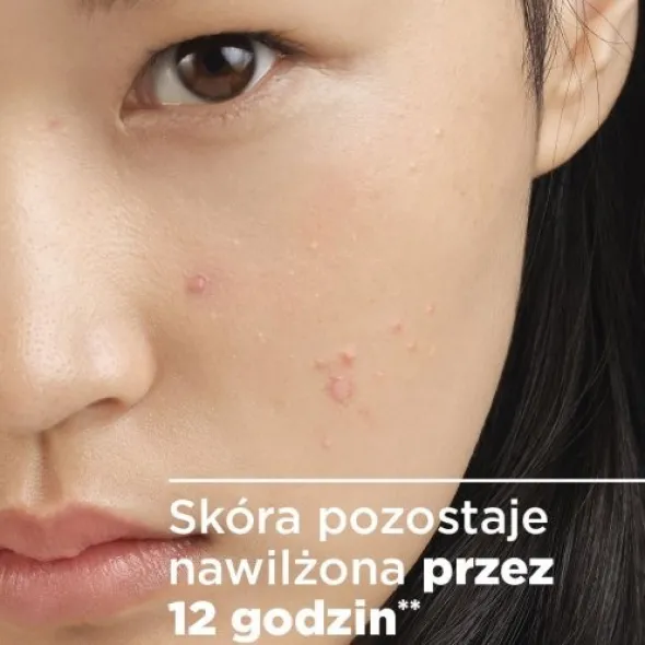 Bioderma Sebium Sensitive, łagodzący krem wspomagający leczenie skóry trądzikowej, 30 ml