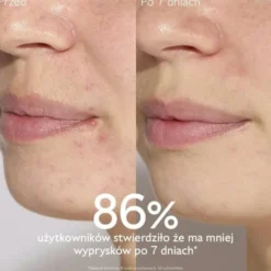 Caudalie Vinopure, serum na niedoskonałości z kwasem salicylowym, 30 ml