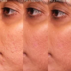 Caudalie Vinopure, serum na niedoskonałości z kwasem salicylowym, 30 ml