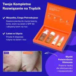 Dermz Laboratories Vitumisil Anti-Acne Set, pianka, 100 ml +toner, 150 ml, krem na dzień, 50 ml + krem na noc, 50 ml
