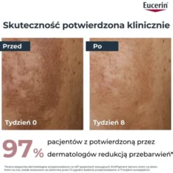 Eucerin Anti-Pigment, serum o podwójnym działaniu z Thiamidolem, przeciw przebarwieniom, 30 ml