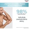 Eucerin AtopiControl, krem łagodzący w fazie zaostrzenia AZS, 100 ml