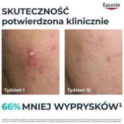 Eucerin Dermopure Clinical, serum o potrójnym działaniu, 40 ml