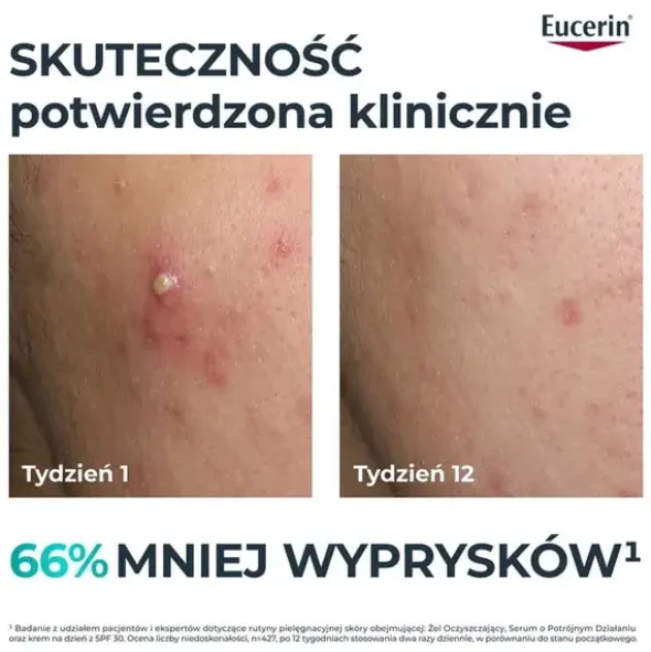Eucerin Dermopure Clinical, serum o potrójnym działaniu, 40 ml