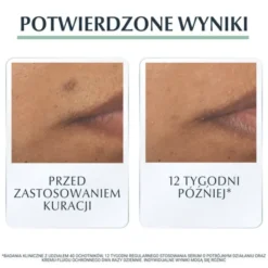 Eucerin DermoPure, serum o potrójnym działaniu z Thiamidolem do skóry ze skłonnością do trądziku, 40 ml
