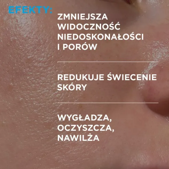 Idee Derm, dermatologiczny tonik mikrozłuszczający, 220 ml