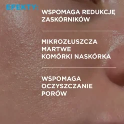 Idee Derm, serum zwalczające trądzik z kwasami, 30 ml