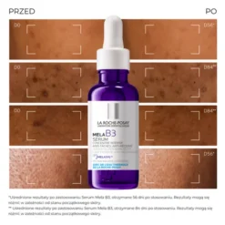 La Roche-Posay Mela B3, skoncentrowane serum przeciw przebarwieniom, 30 ml