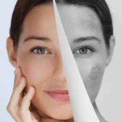 Miraculum Anti-Pigmentation, krem do rąk korygujący przebarwienia, 75 ml