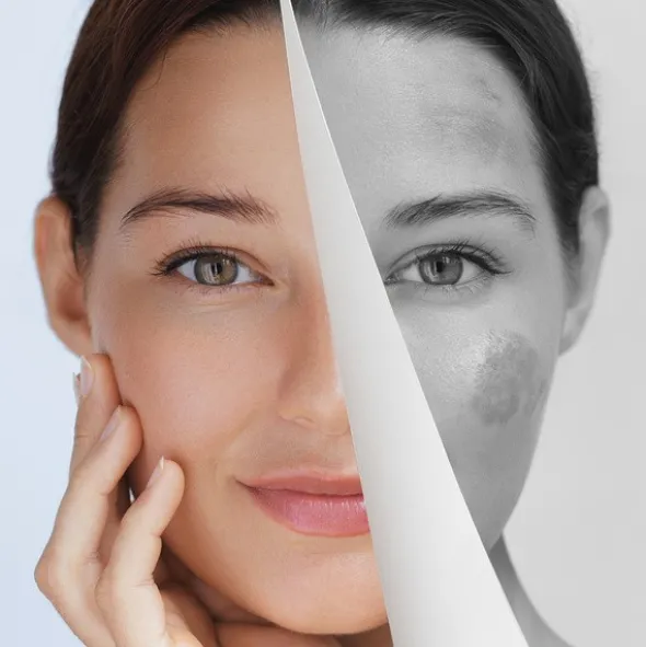 Miraculum Anti-Pigmentation, krem do rąk korygujący przebarwienia, 75 ml