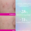 Nuxe Zinc Power, serum przeciw niedoskonałościom i wypryskom, 30 ml
