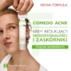 Pharmaceris T Comedo Acne, krem redukujący niedoskonałości i zaskórniki trądziku młodzieńczego, 40 ml