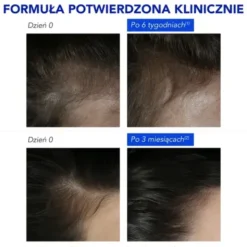 Phyto Phytophanere, kuracja przeciw reakcyjnemu wypadaniu włosów, 12 x 5 ml