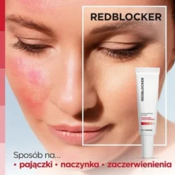RedBlocker, serum punktowe, skóra naczynkowa, 30 ml