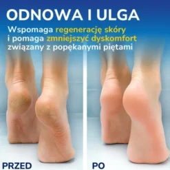 Scholl, krem regenerujący na popękane pięty, 60 ml