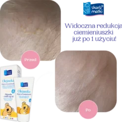 Skarb Matki, Olejuszka, olejek na ciemieniuszkę, 30 ml