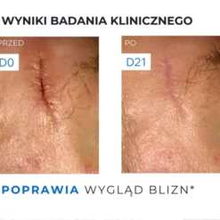 Uriage Bariederm CICA, krem regenerujący, Cu-Zn, 100 ml