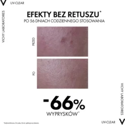 Vichy Capital Soleil, fluid przeciw niedoskonałościom, SPF 50+, 40 ml