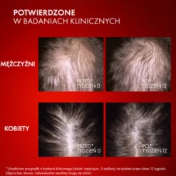 Vichy Dercos Aminexil R.E.G.E.N., serum wzmacniające i stymulujące włosy, 90 ml