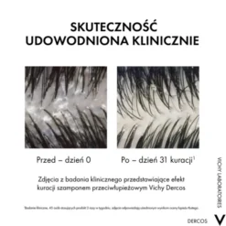 Vichy Dercos DS, szampon przeciwłupieżowy z odżywką 2w1, 390 ml