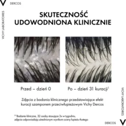 Vichy Dercos DS, szampon przeciwłupieżowy, włosy normalne i przetłuszczające się, 390 ml