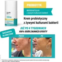 Yun ACN Repair Cream, krem probiotyczny, 50 ml