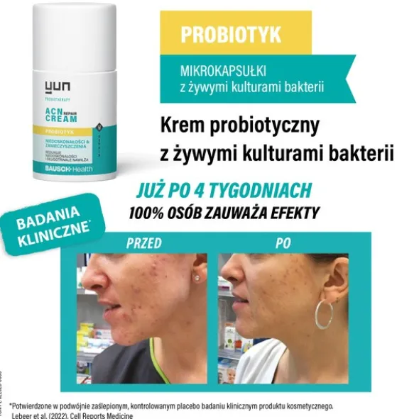 Yun ACN Repair Cream, krem probiotyczny, 50 ml